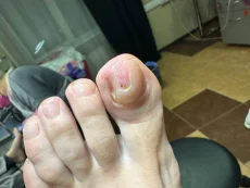 Подология подолог