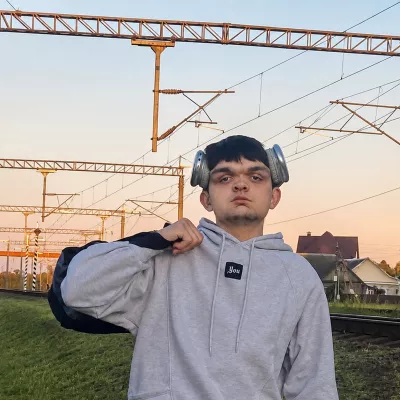 «Плакал и молился, чтобы проснуться нормальным». 16-летний бобруйчанин рассказал о генетическом заболевании и принятии себя