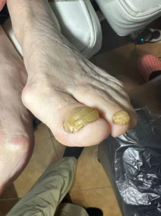 Подология подолог