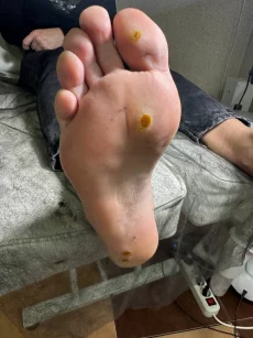 Подология подолог