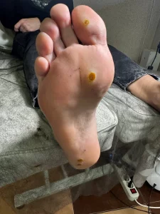 Подология подолог