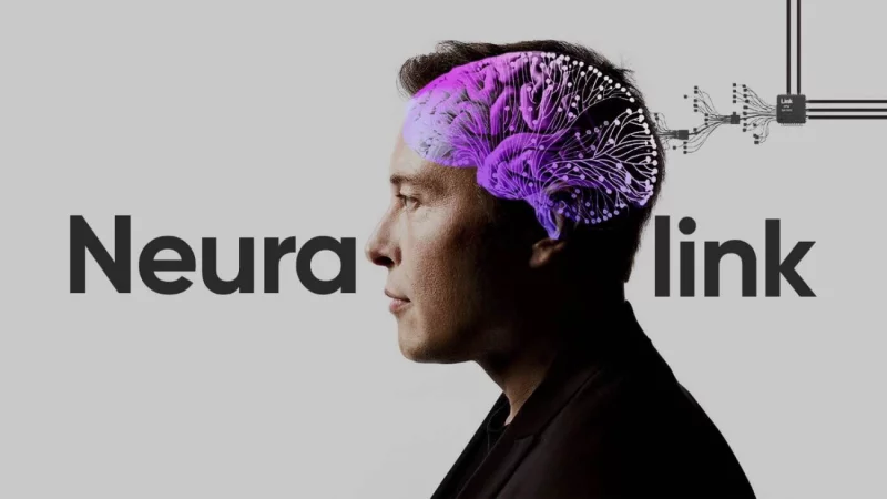 Стартап Neuralink Илона Маска впервые вживил чип в мозг человека