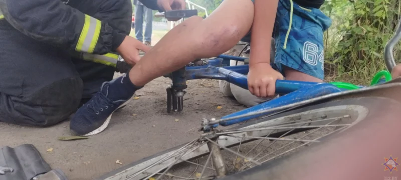 В Бобруйске педаль велосипеда пронзила ногу ребенку: на помощь пришло МЧС
