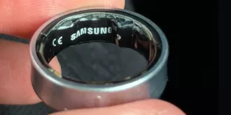 Умное кольцо Galaxy Ring вздулось прямо на пальце — владельцу пришлось ехать в больницу