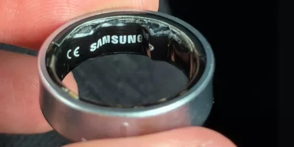 Умное кольцо Galaxy Ring вздулось прямо на пальце — владельцу пришлось ехать в больницу