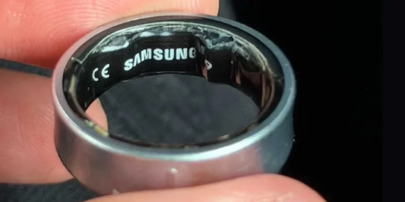 Умное кольцо Galaxy Ring вздулось прямо на пальце — владельцу пришлось ехать в больницу
