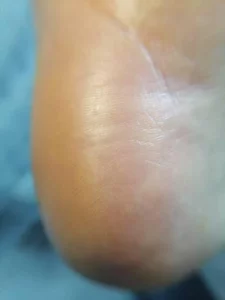 Подология подолог