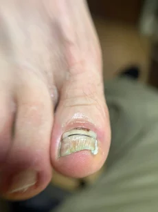 Подология подолог