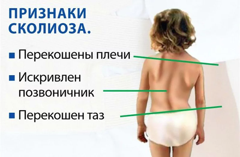 Здоровые спины нашим детям! Акция в Марижель: бесплатная коррекция осанки