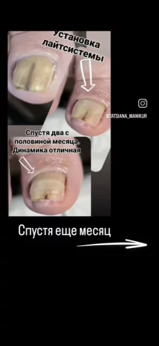 Подолог, Маникюр, Педикюр