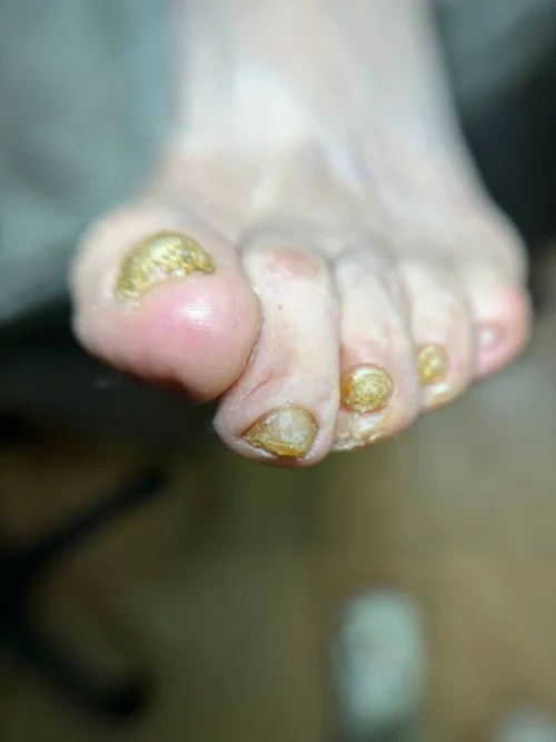 Подология подолог