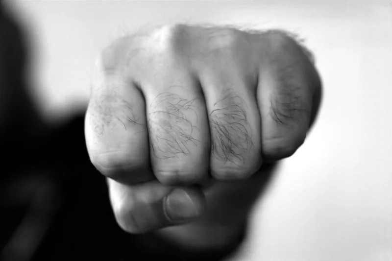 Сломанный нос могилевчанки обошелся обидчику в 1700 рублей, хотя пострадавшая не писала заявление в милицию. Кому он оказался должен такую сумму?