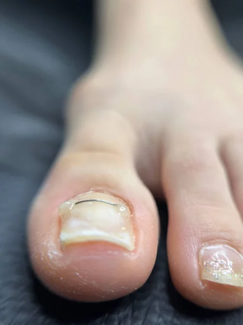 Подология подолог