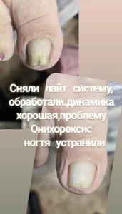 Подолог, Маникюр, Педикюр