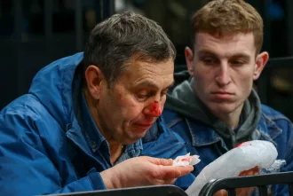 Шайба попала в лицо бобруйчанину-болельщику на матче минского «Динамо». Но болеть за любимую команду он не перестанет