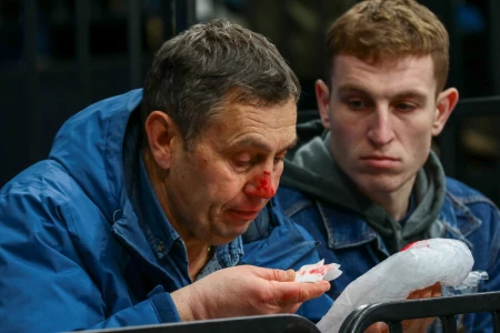 Шайба попала в лицо бобруйчанину-болельщику на матче минского «Динамо». Но болеть за любимую команду он не перестанет