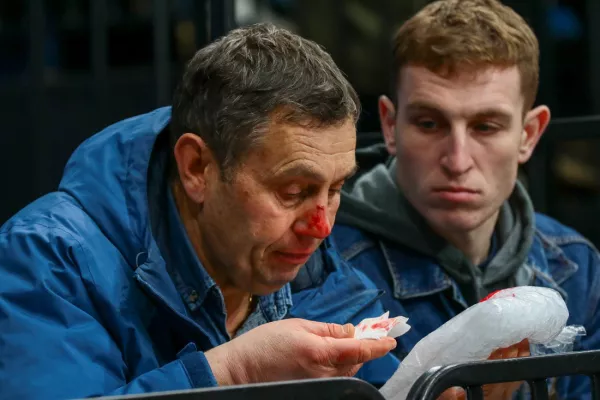 Шайба попала в лицо бобруйчанину-болельщику на матче минского «Динамо». Но болеть за любимую команду он не перестанет