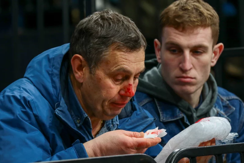 Шайба попала в лицо бобруйчанину-болельщику на матче минского «Динамо». Но болеть за любимую команду он не перестанет