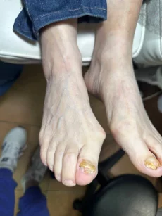 Подология подолог